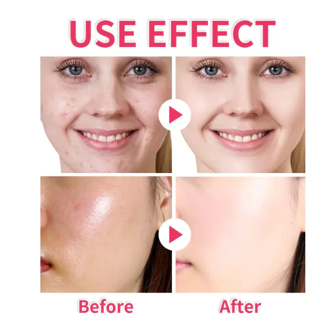 Tumeric Cleansing Pads Effects